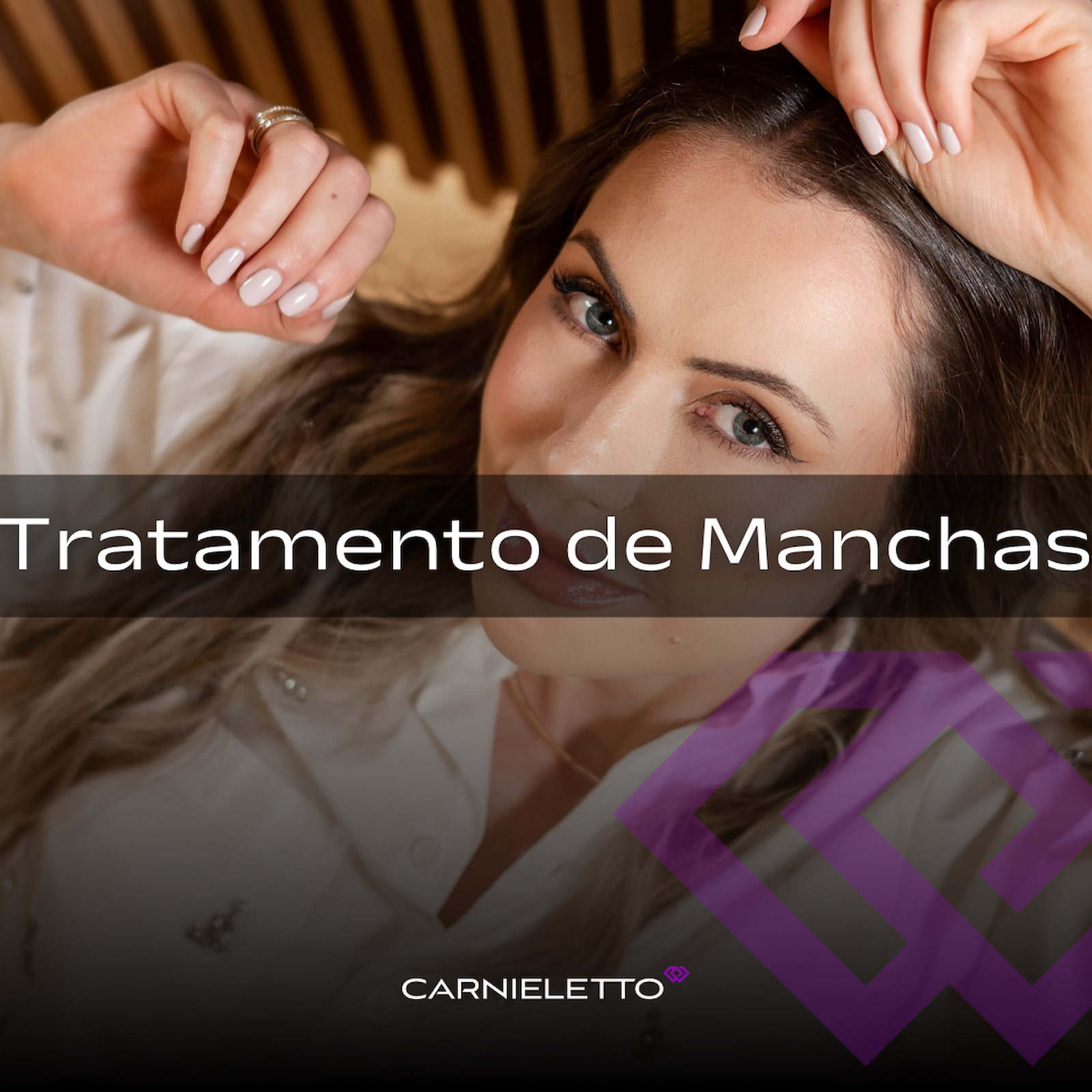 Tratamento de Manchas em Cascavel na Clínica Carnieletto