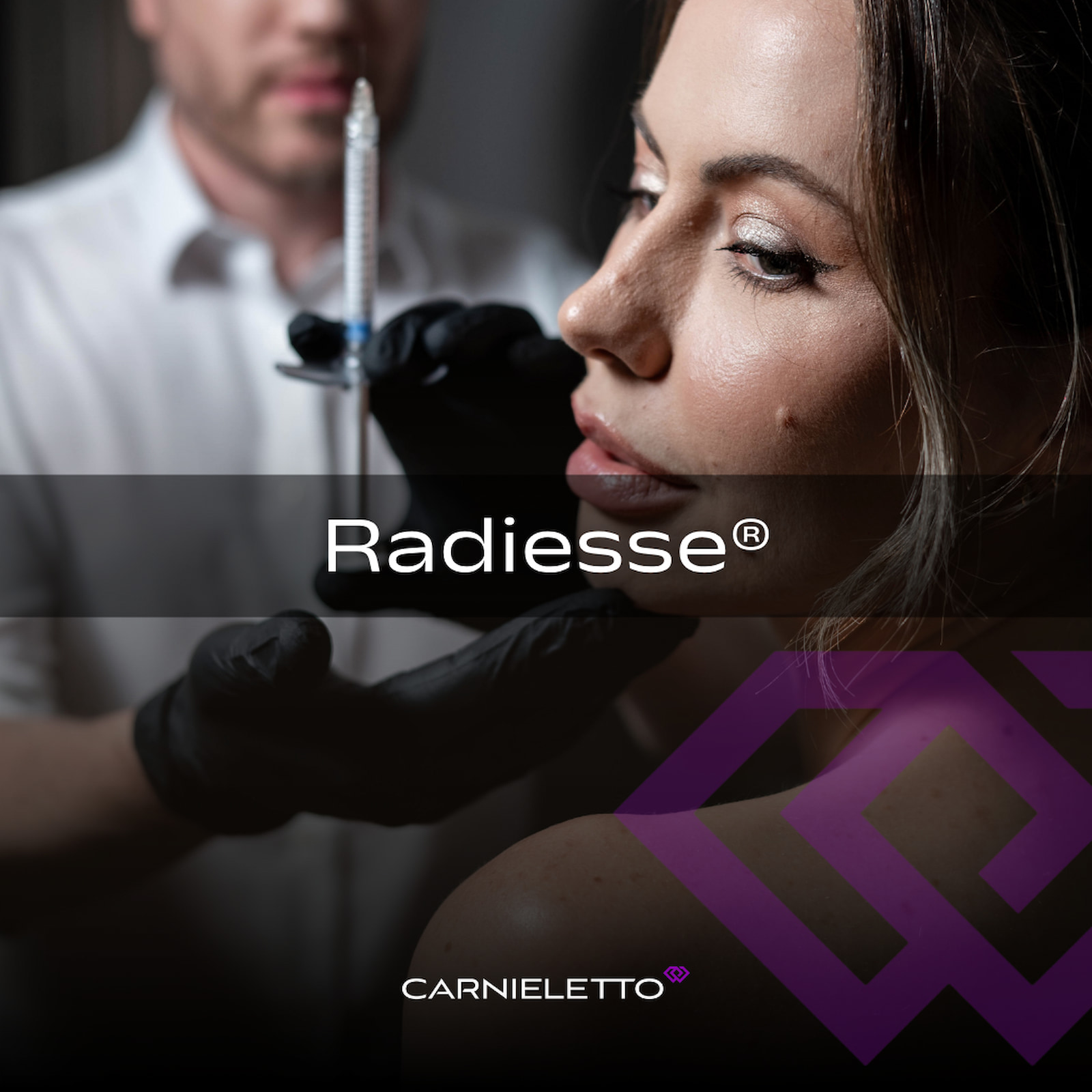 Radiesse em Cascavel para estimular colágeno